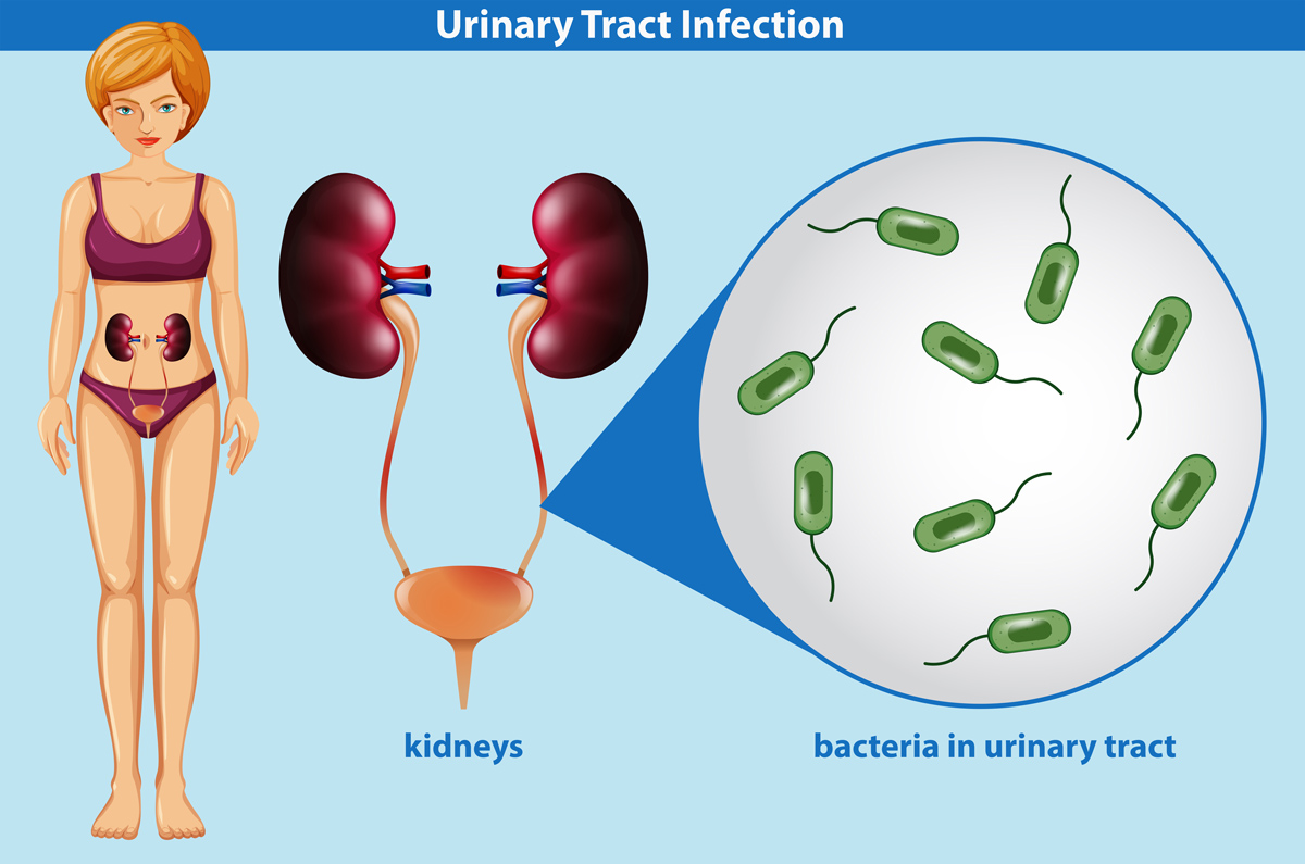 infection urinaire contagieux