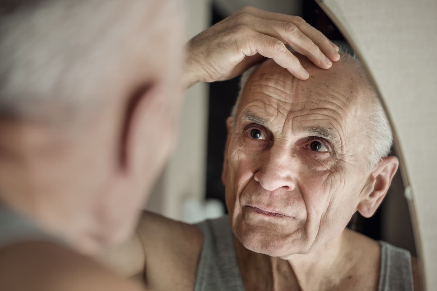 greffe de cheveux seniors